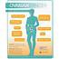 What Are The Symptoms Of Ovarian Cancer Infographic  Dana Farber