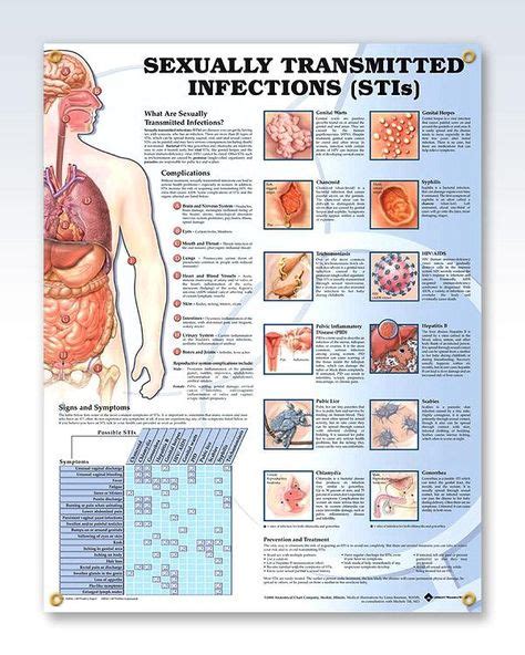 Sexually Transmitted Infections Chart 20x26 Nursing Students Medical