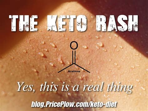 Keto Diet Supplements Compare Products At Priceplow