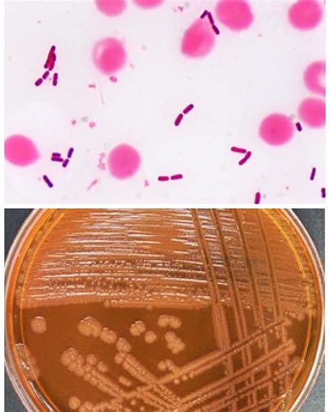 Proteus Mirabilis Microbiology Microbiologia Bacteriologia Bacteria