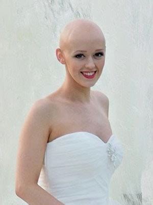 Ciara S Story Cancer Baldness And Finding Your Beauty Allure