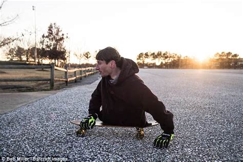 Man With Half A Body Rowdy Burton Forced To Get Around On His Hands Daily Mail Online