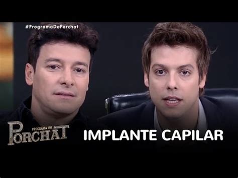 Falar sobre implante e transplante capilar ? Rodrigo Faro analisa sugestões para implante capilar - YouTube