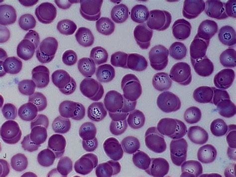 16 Best Images About Babesia Microti On Pinterest Poppies Maltese