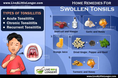 Natural Ways To Cure Swollen Tonsils Live A Little Longer