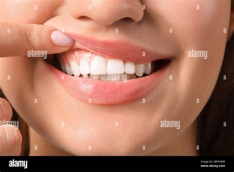 Healthy Gums Hi Res Stock Photography And Images Alamy