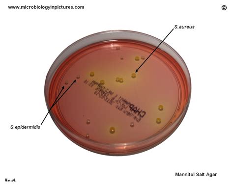 Staphylococcus Epidermidis On Agar Plate With Mannitol Salt Agar