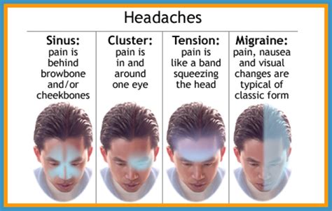 What Is A Migraine Migraine Headaches The Basics Learn More About