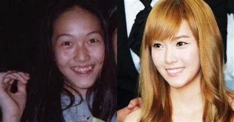 Japanese Artist Plastic Surgery Before After