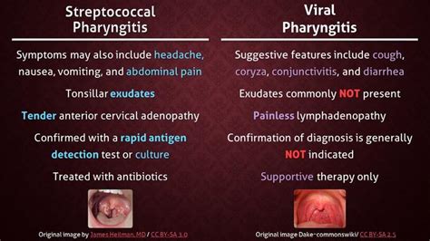Streptococcal Vs Viral Pharyngitis Usmle Forums