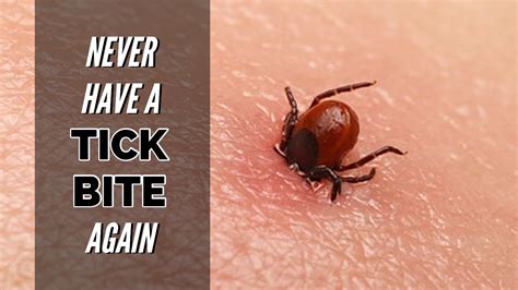 Kill Ticks And Prevent Lyme Disease Youtube
