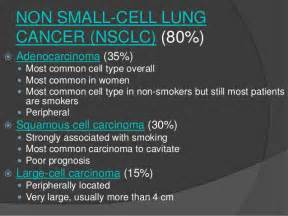 Lung Cancer Radiology