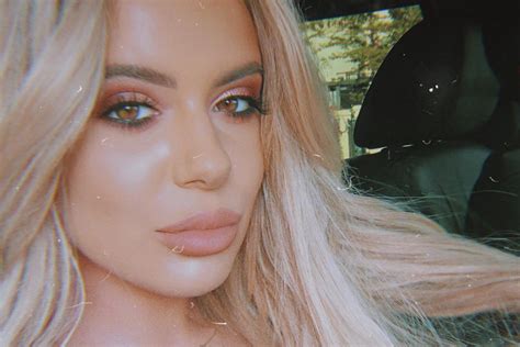 Brielle Biermann On Getting Lip Injections At Age 18 Plastic Surgery The Daily Dish