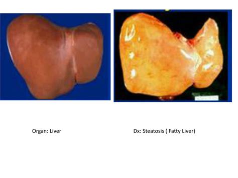 Ppt Hepatobiliary System Powerpoint Presentation Free Download Id
