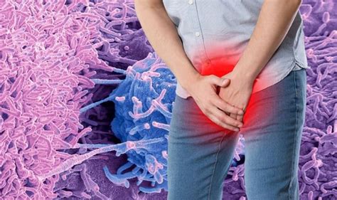 Prostate Cancer Symptoms Include Blood Or Semen In Urine Express Co Uk