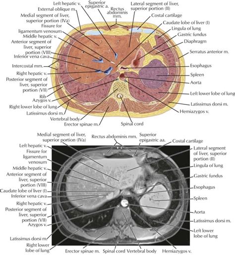 Abdomen Radiology Key