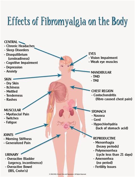 effects of fibromyalgia on your body chronic fatigue costochondritis fibromyalgia