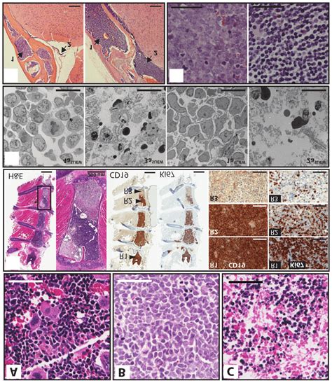 Histological Sections Of Bone Marrow From Controls And Xenografts