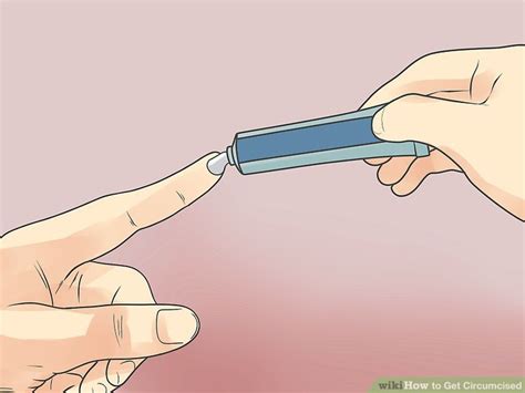 How To Get Circumcised Steps With Pictures Wikihow