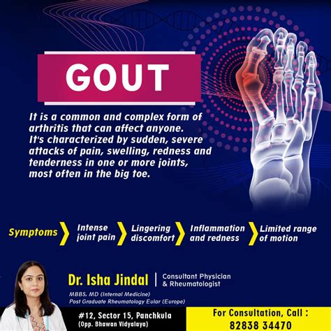 Understanding Gout Symptoms Causes Risk Factors And Prevention Dr
