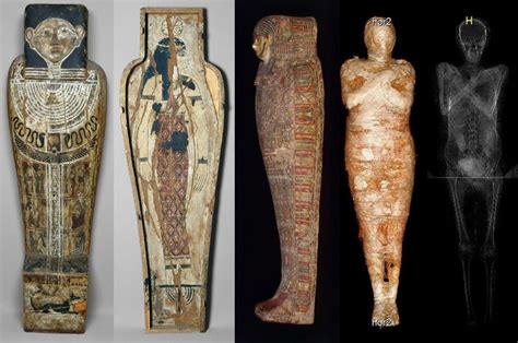 Scientists Discover Worlds First Pregnant Ancient Egyptian Mummy