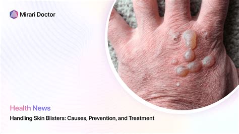 Handling Skin Blisters Causes Prevention And Treatment