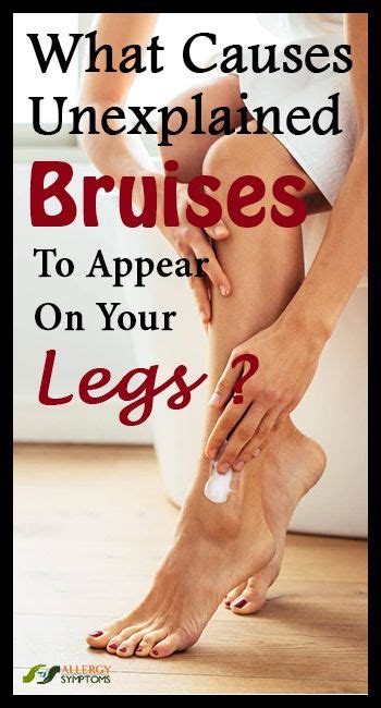 What Causes Unexplained Bruises To Appear On Your Legs Bruises Legs