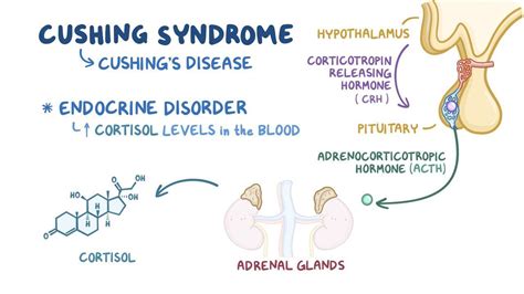 Cushings Syndrome Pathophysiology