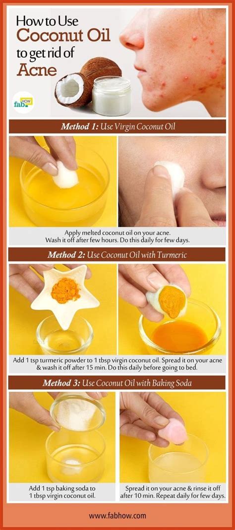 Homemade Acne Remedies Alternative To Acne Care At Home Acne
