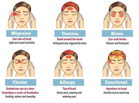 Migraine Of Spanningshoofdpijn Botuline Toxine Helpt Yourface