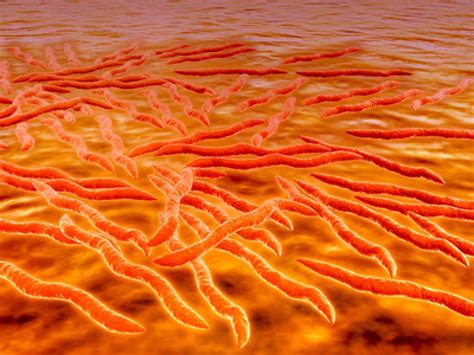 The most common sign of infection is an expanding red rash, known as erythema migrans, that appears at the site of the tick bite about a week after it occurred. Borelioza.CZ - Spirochety jako předobraz chirurgických ...