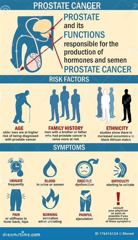 Infographics Of Prostate Cancer Illustration Prostate Cancer Symptoms Risk Factors Stock
