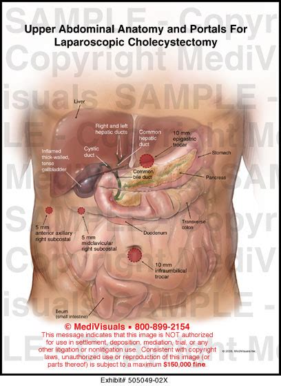 Anatomy Of Upper Abdominal Organs Abdominal Pain Cuteness