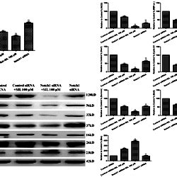 Effects Of Combined Sil Treatment And Notch Sirna Transfection On Cell