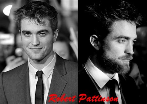 Robert Pattinson Nose Job Before And After Plastic Surgery Pics Plastic Surgery Before