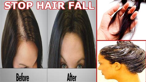 If you are facing a hair fall problem then this oil is the best. STOP HAIR FALL NATURALLY | BEST HAIR MASK- 100% EFFECTIVE ...
