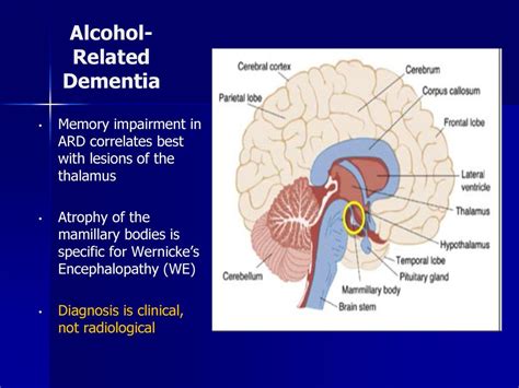 A Complex Relationship Between Alcohol And Dementia Vistasol Medical Group