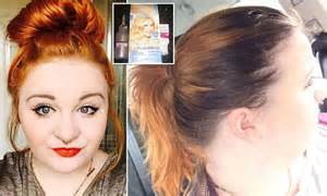 Woman Who Used A Truly Blonde Hair Dye Is Left With Three Inches Of
