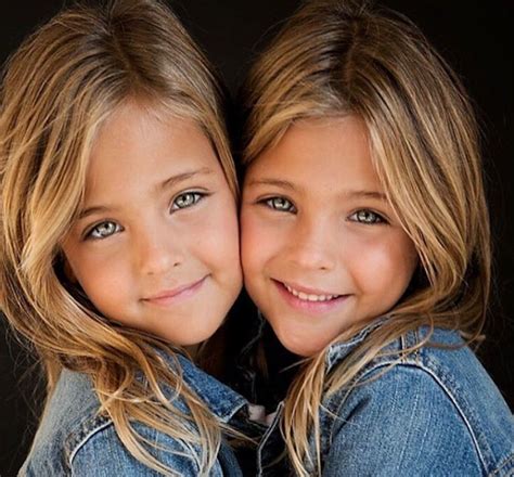 They Called Them The Worlds Most Beautiful Twins 9 Years Ago But Now
