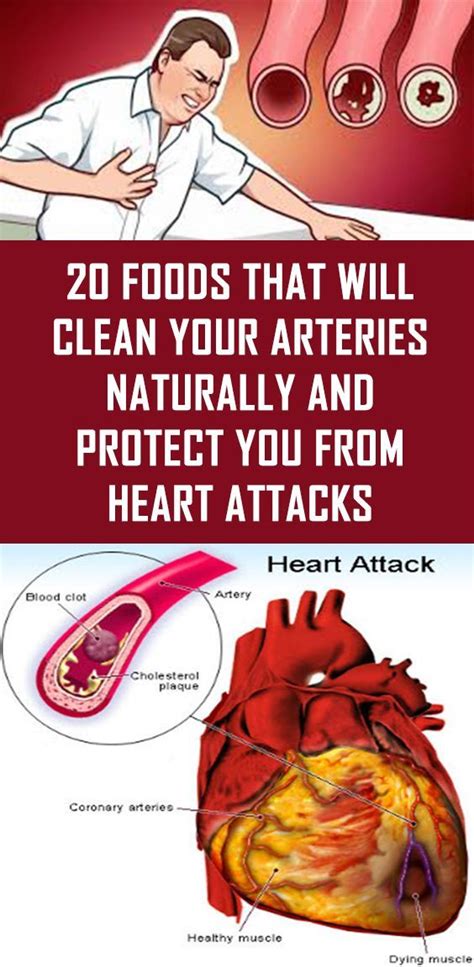 We did not find results for: 20 Foods That Will Clean Your Arteries Naturally and ...