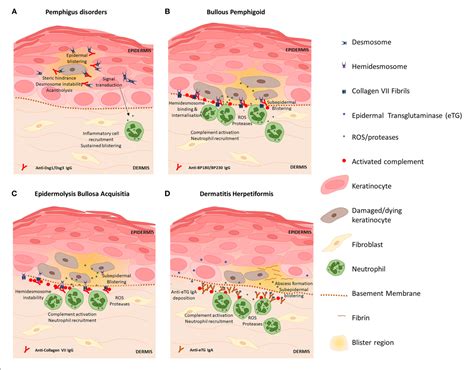 Table 1 From Skin Barrier And Autoimmunity—mechanisms And Novel