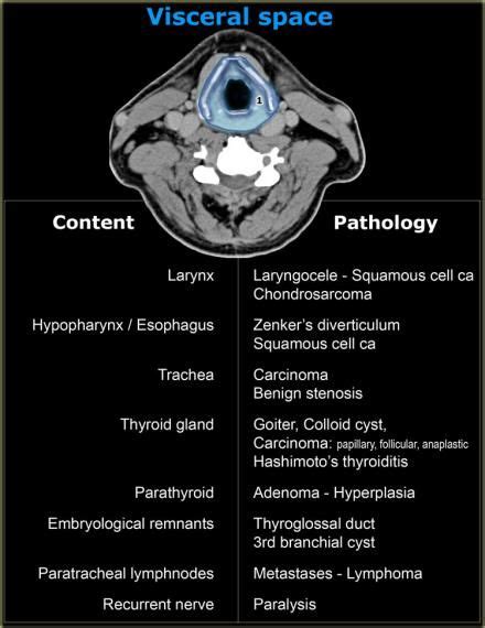 Infrahyoid Neck Pathology Radiology Diagnostic Imaging