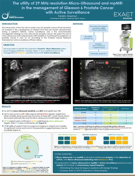 PDF The Utility Of MHz High Resolution Micro Ultrasound And MpMRI In The Management Of