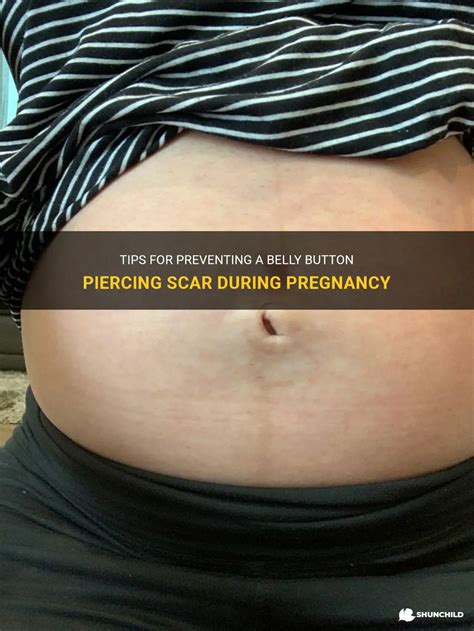 Tips For Preventing A Belly Button Piercing Scar During Pregnancy