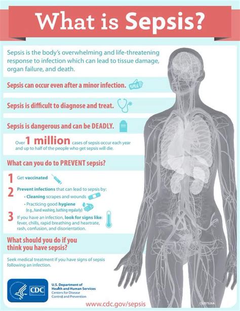 Infographic How To Prevent—and Treat—sepsis Articles Sepsis