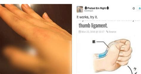 This Man Sent Out Instructions To Break Your Thumb Ligament Generation Dummy Sent Back Their