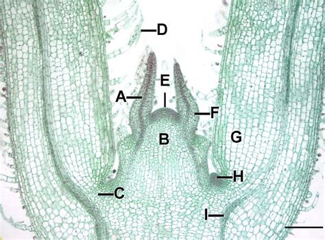 Difference Between Apical And Lateral Meristems Definition