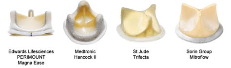 A Composite Of Bioprosthetic Valves From Each Of The Four Major