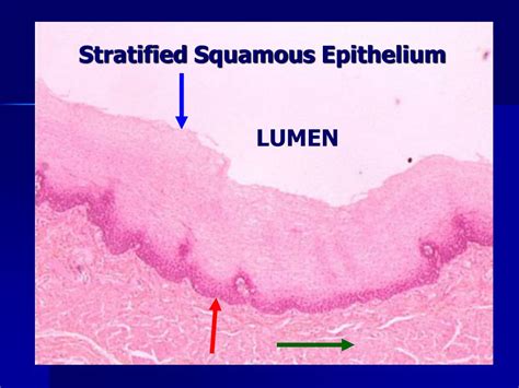 Ppt Lab Exercise Classification Of Tissues Epithelial Tissue