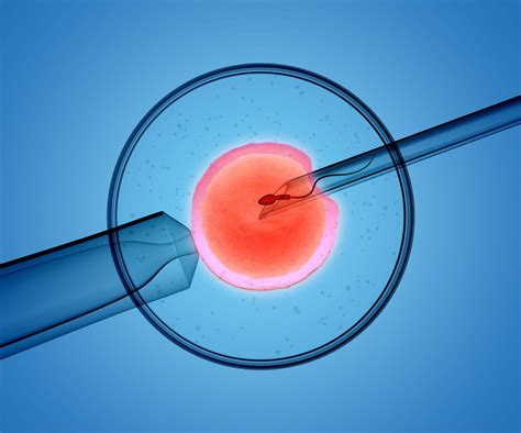 What Is Intrauterine Insemination IUI Path Fertility